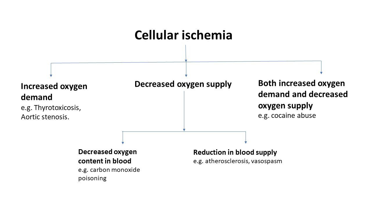 Ischemic Heart Disease Ihd